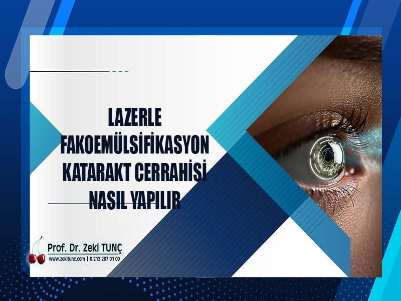 lazerle-fakoemulsifikasyon-katarakt-cerrahisi-nasil-yapilir