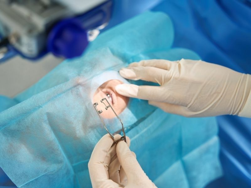 goz-cizdirme-ameliyati-kalici-mi