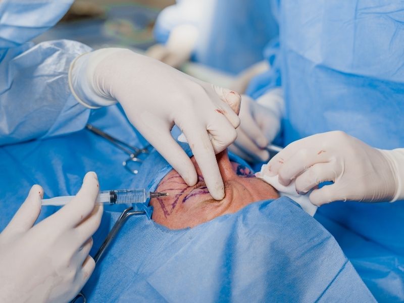 goz-cizdirme-ameliyati-nasil-yapilir